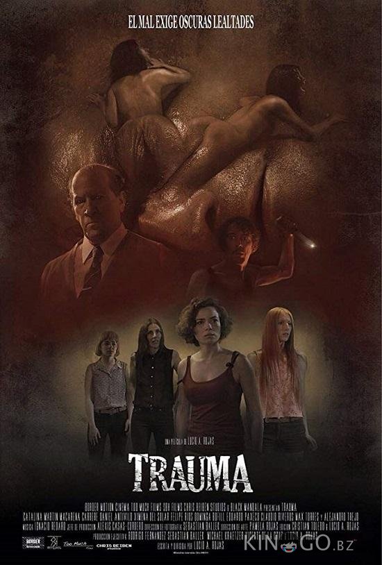 Травма Травма