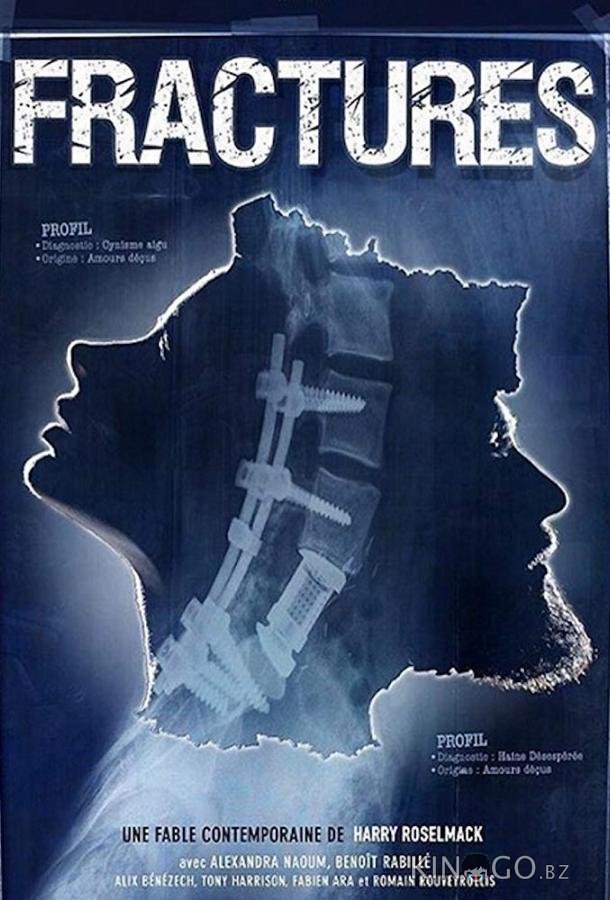 Перелом Перелом